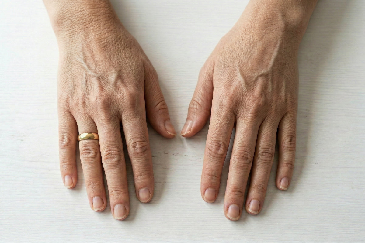 What Causes Crepey Skin and How to Improve Elasticity