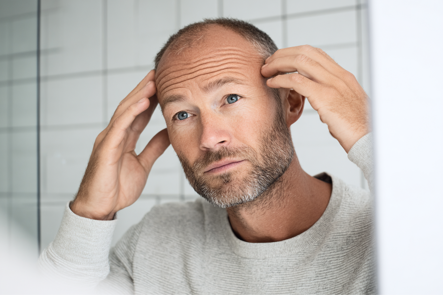 Hair Loss Myths: The Truth Behind Hair Loss and What Actually Works