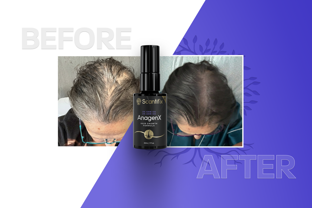 ghk-cu hair before and after AnagenX & After: Real Results from Real Customers BPC-157 20mg kopen |
